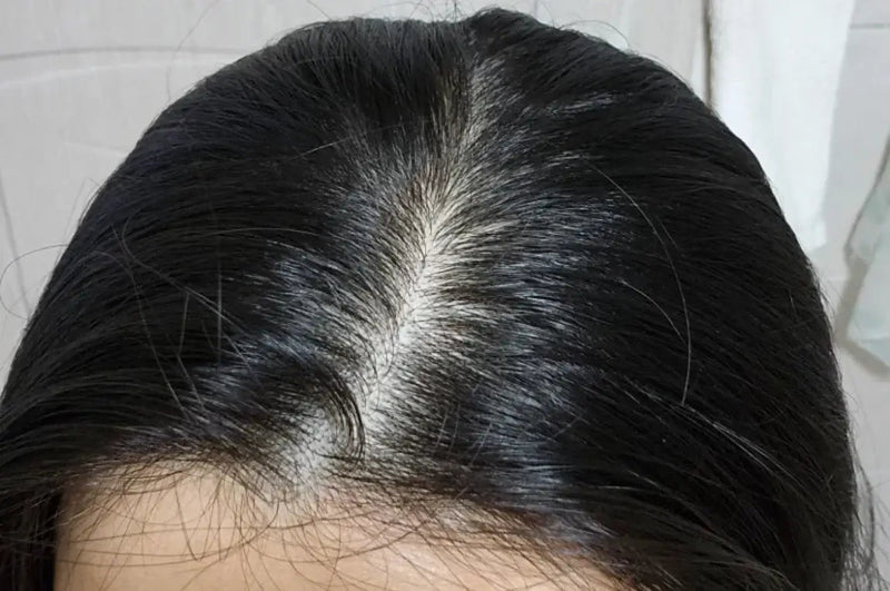 Force des cheveux